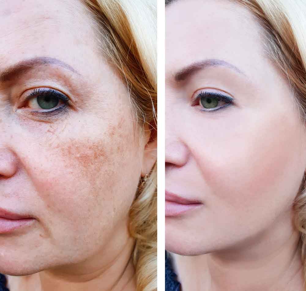 Ageless Before And After Image 3 Anti Age Naturally 